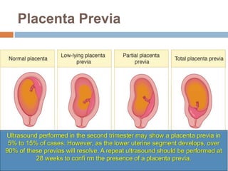 Placenta Previa
Ultrasound performed in the second trimester may show a placenta previa in
5% to 15% of cases. However, as the lower uterine segment develops, over
90% of these previas will resolve. A repeat ultrasound should be performed at
28 weeks to confi rm the presence of a placenta previa.
 