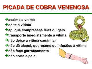 PICADA DE COBRA VENENOSAPICADA DE COBRA VENENOSA
acalme a vítima
deite a vítima
aplique compressas frias ou gelo
transporte imediatamente a vítima
não deixe a vítima caminhar
não dê álcool, querosene ou infusões à vítima
não faça garroteamento
não corte a pele
 