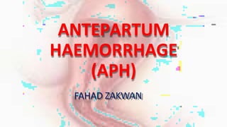 ANTEPARTUM
HAEMORRHAGE
(APH)
FAHAD ZAKWAN
 
