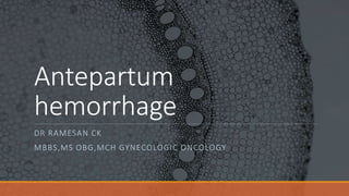 Antepartum
hemorrhage
DR RAMESAN CK
MBBS,MS OBG,MCH GYNECOLOGIC ONCOLOGY
 