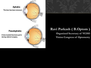 Ravi Parkash ( B.Optom )
Organized Secretary of VCOO
Vision Congress of Optometry
 