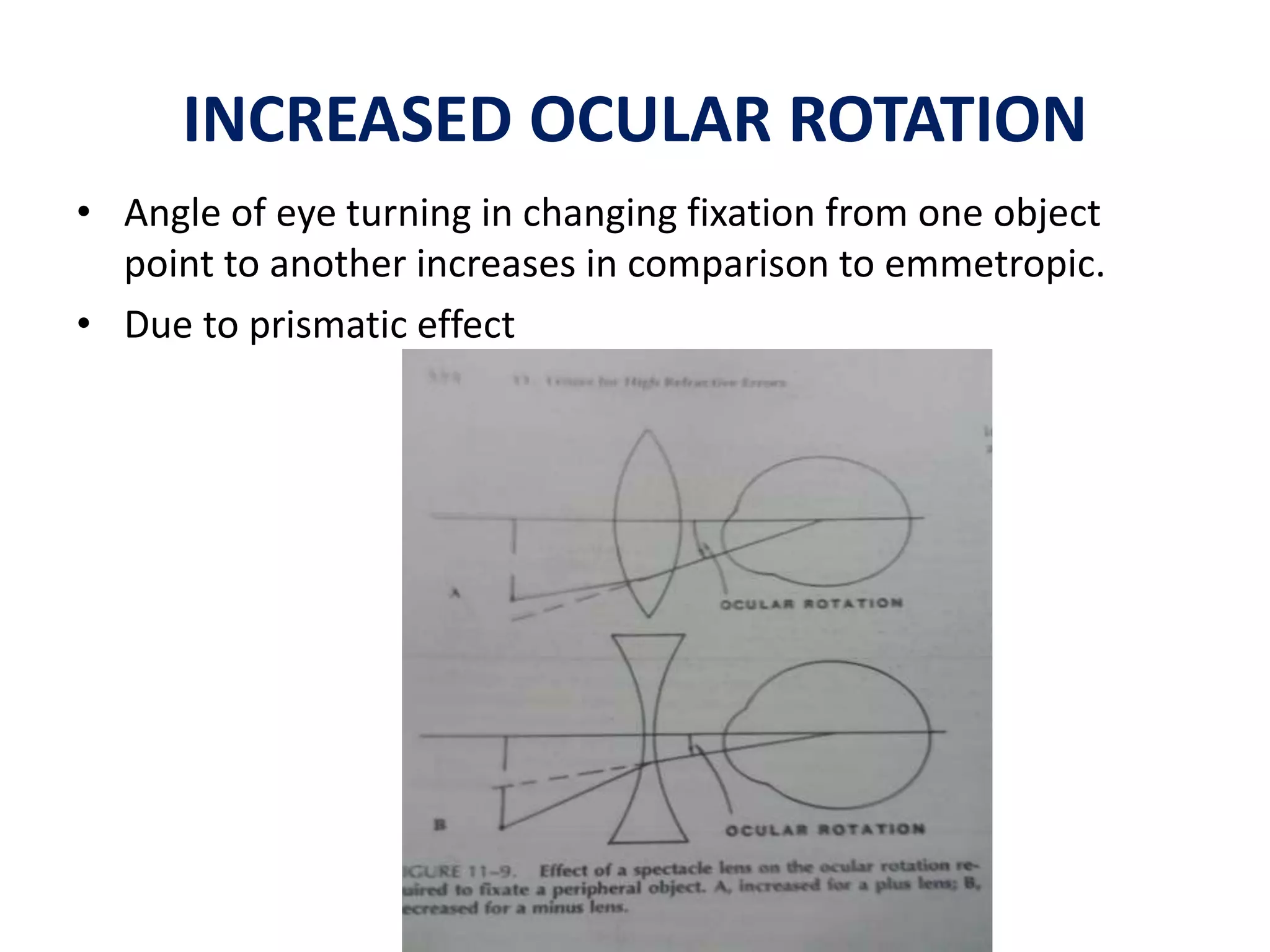 INCREASED OCULAR ROTATION
• Angle of eye turning in changing fixation from one object
point to another increases in comparison to emmetropic.
• Due to prismatic effect
 