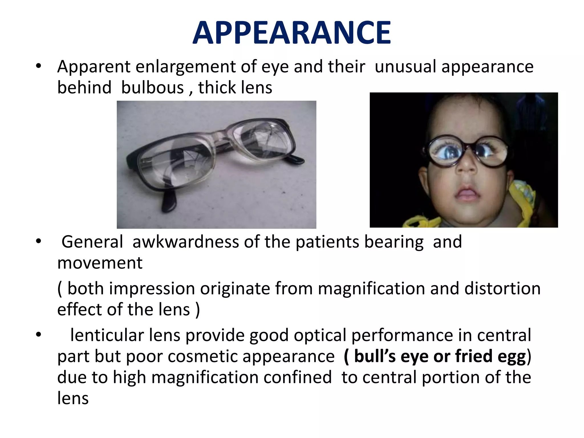 APPEARANCE
• Apparent enlargement of eye and their unusual appearance
behind bulbous , thick lens
• General awkwardness of the patients bearing and
movement
( both impression originate from magnification and distortion
effect of the lens )
• lenticular lens provide good optical performance in central
part but poor cosmetic appearance ( bull’s eye or fried egg)
due to high magnification confined to central portion of the
lens
 