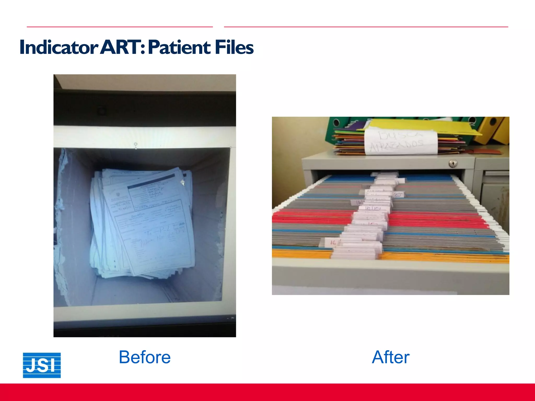 IndicatorART:Patient Files
Before After
 