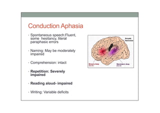 Aphasia and common aphasia syndromes.pdf