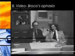 B. Video- Broca’s aphasia
 