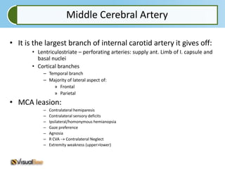 Middle Cerebral Artery

• It is the largest branch of internal carotid artery it gives off:
       • Lentriculostriate – perforating arteries: supply ant. Limb of I. capsule and
         basal nuclei
       • Cortical branches
           – Temporal branch
           – Majority of lateral aspect of:
               » Frontal
               » Parietal
• MCA leasion:
           –   Contralateral hemiparesis
           –   Contralateral sensory deficits
           –   Ipsilateral/homonymous hemianopsia
           –   Gaze preference
           –   Agnosia
           –   R CVA Contralateral Neglect
           –   Extremity weakness (upper>lower)
 