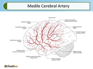 Medile Cerebral Artery
 