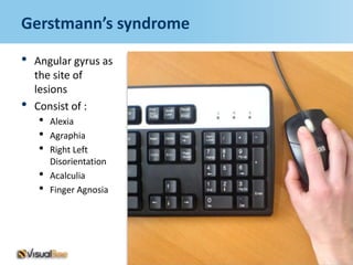 Gerstmann’s syndrome

•   Angular gyrus as
    the site of
    lesions
•   Consist of :
    •   Alexia
    •   Agraphia
    •   Right Left
        Disorientation
    •   Acalculia
    •   Finger Agnosia
 
