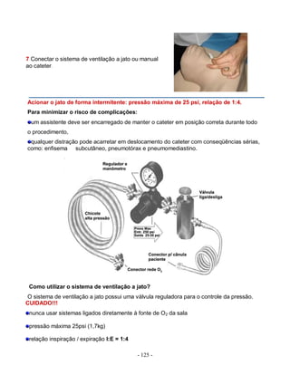 - 125 -
7 Conectar o sistema de ventilação a jato ou manual
ao cateter.
Acionar o jato de forma intermitente: pressão máxima de 25 psi, relação de 1:4.
Para minimizar o risco de complicações:
um assistente deve ser encarregado de manter o cateter em posição correta durante todo
o procedimento,
qualquer distração pode acarretar em deslocamento do cateter com conseqüências sérias,
como: enfisema subcutâneo, pneumotórax e pneumomediastino.
Como utilizar o sistema de ventilação a jato?
O sistema de ventilação a jato possui uma válvula reguladora para o controle da pressão.
CUIDADO!!!
nunca usar sistemas ligados diretamente à fonte de O2 da sala
pressão máxima 25psi (1,7kg)
relação inspiração / expiração I:E = 1:4
 
