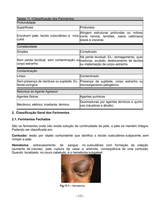- 132 -
Tabela 11.1Classificação dos Ferimentos
Profundidade
Superficiais Profundos
Envolvem pele, tecido subcutâneo e mús-
culos
Atingem estruturas profundas ou nobres,
como nervos, tendões, vasos calibrosos,
ossos e vísceras
Complexidade
Simples Complicado
Sem perda tecidual, sem contaminação ou
corpo estranho
Há perda tecidual. Ex.: esmagamento, quei-
maduras, avulsão, deslocamento de tecidos
ou implantação de corpo estranho
Contaminação
Limpo Contaminado
Sem presença de resíduos ou sujidade. Ex.:
ferida cirúrgica
Presença de sujidade, corpo estranho ou
microorganismo patogênico
Natureza do Agente Agressor
Agentes físicos Agentes químicos
Mecânico, elétrico, irradiante, térmico
Queimaduras por agentes térmicos e quími-
cos (cáusticos e álcalis)
2. Classificação Geral dos Ferimentos
2.1. Ferimentos Fechados
São os ferimentos onde não existe solução de continuidade da pele, a pele se mantém Integra.
Podendo ser classificada em:
Contusão: lesão por objeto contundente que danifica o tecido subcutâneo subjacente, sem
romper a pele.
Hematoma: extravasamento de sangue no subcutâneo com formação de coleção
(aumento de volume), pela ruptura de veias e arteríola, conseqüência de uma contusão.
Quando localizado no couro cabeludo, é o hematoma subgaleal.
Fig 11.1 – Hematoma
 