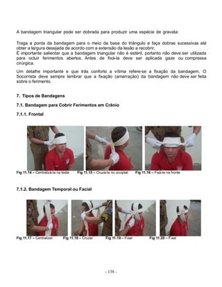 - 138 -
A bandagem triangular pode ser dobrada para produzir uma espécie de gravata:
Traga a ponta da bandagem para o meio da base do triângulo e faça dobras sucessivas até
obter a largura desejada de acordo com a extensão da lesão a recobrir.
É importante salientar que a bandagem triangular não é estéril, portanto não deve ser utilizada
para ocluir ferimentos abertos. Antes de fixá-la deve ser aplicada gaze ou compressa
cirúrgica.
Um detalhe importante e que trás conforto a vítima refere-se a fixação da bandagem. O
Socorrista deve sempre lembrar que a fixação (amarração) da bandagem não deve ser feita
sobre o ferimento.
7. Tipos de Bandagens
7.1. Bandagem para Cobrir Ferimentos em Crânio
7.1.1. Frontal
Fig 11.14 – Centralizá-la na testa. Fig 11.15 – Cruzá-la no occiptal. Fig 11.16 – Fixá-la na fronte
7.1.2. Bandagem Temporal ou Facial
Fig 11.17 – Centralizar Fig 11.18 – Cruzar Fig 11.19 – Fixar Fig 11.20 – Fixar
 