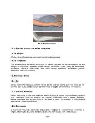 - 153 -
Fig 12.4 – Fratura fechada
1.1.3. Quanto à presença de lesões associadas
1.1.3.1. simples:
A fratura é uma lesão única, sem evidência de lesão associada.
1.1.3.2 complicada
Está acompanhada de lesões associadas. O trauma causador de fratura exposta é de alta
energia e velocidade, podendo ocorrer lesões associadas locais, como as musculares,
tendinosas, nervosas, vasculares, bem como lesões sistêmicas associadas (trauma
abdominal, torácico e craniano).
1.2. Sintomas e Sinais
1.2.1. Dor
Devido ao trauma localizado, sempre haverá dor no local da fratura, que varia muito de um
paciente para outro, sendo aliviada por manobras de tração, alinhamento e imobilização.
1.2.2. Aumento de volume
Devido ao trauma, ocorre uma lesão dos tecidos vizinhos a fratura, produzindo sangramento
local, detectado como um aumento de volume, produzindo, com o passar do tempo,
edema localizado. Em algumas fraturas, de fêmur e pélvis, por exemplo, o sangramento
pode causar choque hipovolêmico.
1.2.3. Deformidade
O segmento fraturado apresenta angulações, rotações e encurtamentos evidentes a
simples observação da vítima, comparando-se o membro lesado com o não afetado.
 