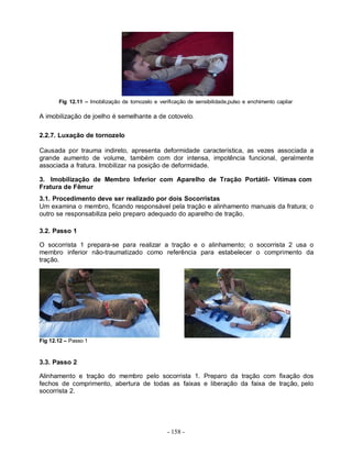 - 158 -
Fig 12.11 – Imobilização de tornozelo e verificação de sensibilidade,pulso e enchimento capilar
A imobilização de joelho é semelhante a de cotovelo.
2.2.7. Luxação de tornozelo
Causada por trauma indireto, apresenta deformidade característica, as vezes associada a
grande aumento de volume, também com dor intensa, impotência funcional, geralmente
associada a fratura. Imobilizar na posição de deformidade.
3. Imobilização de Membro Inferior com Aparelho de Tração Portátil- Vítimas com
Fratura de Fêmur
3.1. Procedimento deve ser realizado por dois Socorristas
Um examina o membro, ficando responsável pela tração e alinhamento manuais da fratura; o
outro se responsabiliza pelo preparo adequado do aparelho de tração.
3.2. Passo 1
O socorrista 1 prepara-se para realizar a tração e o alinhamento; o socorrista 2 usa o
membro inferior não-traumatizado como referência para estabelecer o comprimento da
tração.
Fig 12.12 – Passo 1
3.3. Passo 2
Alinhamento e tração do membro pelo socorrista 1. Preparo da tração com fixação dos
fechos de comprimento, abertura de todas as faixas e liberação da faixa de tração, pelo
socorrista 2.
 