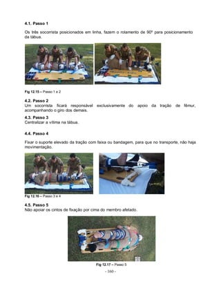 - 160 -
4.1. Passo 1
Os três socorrista posicionados em linha, fazem o rolamento de 90º para posicionamento
da tábua.
Fig 12.15 – Passo 1 e 2
4.2. Passo 2
Um socorrista ficará responsável exclusivamente do apoio da tração de fêmur,
acompanhando o giro dos demais.
4.3. Passo 3
Centralizar a vítima na tábua.
4.4. Passo 4
Fixar o suporte elevado da tração com faixa ou bandagem, para que no transporte, não haja
movimentação.
Fig 12.16 – Passo 3 e 4
4.5. Passo 5
Não apoiar os cintos de fixação por cima do membro afetado.
Fig 12.17 – Passo 5
 