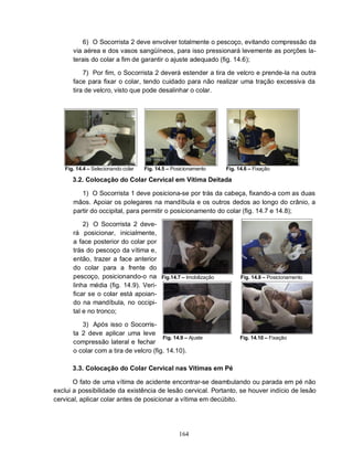 164
6) O Socorrista 2 deve envolver totalmente o pescoço, evitando compressão da
via aérea e dos vasos sangüíneos, para isso pressionará levemente as porções la-
terais do colar a fim de garantir o ajuste adequado (fig. 14.6);
7) Por fim, o Socorrista 2 deverá estender a tira de velcro e prende-la na outra
face para fixar o colar, tendo cuidado para não realizar uma tração excessiva da
tira de velcro, visto que pode desalinhar o colar.
Fig. 14.4 – Selecionando colar Fig. 14.5 – Posicionamento Fig. 14.6 – Fixação
3.2. Colocação do Colar Cervical em Vítima Deitada
1) O Socorrista 1 deve posiciona-se por trás da cabeça, fixando-a com as duas
mãos. Apoiar os polegares na mandíbula e os outros dedos ao longo do crânio, a
partir do occipital, para permitir o posicionamento do colar (fig. 14.7 e 14.8);
2) O Socorrista 2 deve-
rá posicionar, inicialmente,
a face posterior do colar por
trás do pescoço da vítima e,
então, trazer a face anterior
do colar para a frente do
pescoço, posicionando-o na
linha média (fig. 14.9). Veri-
ficar se o colar está apoian-
do na mandíbula, no occipi-
tal e no tronco;
3) Após isso o Socorris-
ta 2 deve aplicar uma leve
compressão lateral e fechar
Fig.14.7 – Imobilização Fig. 14.8 – Posicionamento
Fig. 14.9 – Ajuste Fig. 14.10 – Fixação
o colar com a tira de velcro (fig. 14.10).
3.3. Colocação do Colar Cervical nas Vítimas em Pé
O fato de uma vítima de acidente encontrar-se deambulando ou parada em pé não
exclui a possibilidade da existência de lesão cervical. Portanto, se houver indício de lesão
cervical, aplicar colar antes de posicionar a vítima em decúbito.
 