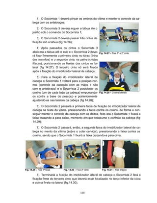 168
1) O Socorrista 1 deverá pinçar os ombros da vítima e manter o controle da ca-
beça com os antebraços;
2) O Socorrista 3 deverá erguer a tábua até o
joelho sob o comando do Socorrista 1;
3) O Socorrista 2 deverá passar três cintos de
fixação sob a tábua (fig 14.26);
4) Após passados os cintos o Socorrista 3
abaixará a tábua até o solo e o Socorrista 2 deve-
rá fixar firmemente o primeiro cinto no tórax (linha
dos mamilos) e o segundo cinto na pelve (cristas
ilíacas), posicionando as fivelas dos cintos na la-
teral (fig 14.27). O terceiro cinto só será fixado
após a fixação do imobilizador lateral de cabeça;
5) Para a fixação do imobilizador lateral de
cabeça o Socorrista 1 voltará para a posição nor-
mal (controle da cabeção com as mãos e não
com o antebraço) e o Socorrista 2 posicionar os
coxins (um de cada lado da cabeça) empurrando-
os contra a base do pescoço e posteriormente
ajustando-os nas laterais da cabeça (fig 14.28);
Fig. 14.27 – Fixa 1° e 2° cinto
Fig. 14.28 – Coxins laterais
6) O Socorrista 2 passará a primeira faixa de fixação do imobilizador lateral de
cabeça na testa da vítima, pressionando a faixa contra os coxins, de forma a con-
seguir manter o controle da cabeça com os dedos, feito isto o Socorrista 1 fixará a
faixa cruzando-a para baixo, momento em que reassume o controle da cabeça (fig
14.29);
7) O Socorrista 2 passará, então, a segunda faixa do imobilizador lateral de ca-
beça no mento da vítima (sobre o colar cervical), pressionando a faixa contra os
coxins, sendo que o Socorrista 1 fixará a faixa cruzando-a para cima;
Fig. 14.29 – Fixa 1ª faixa Fig. 14.30 – Fixa 3º cinto Fig. 14.31 – Fixa braços
8) Terminada a fixação do imobilizador lateral de cabeça o Socorrista 2 fará a
fixação firme do terceiro cinto que deverá estar localizado no terço inferior da coxa
e com a fivela na lateral (fig.14.30);
 