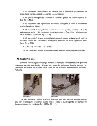 185
4) O Socorrista 1 posiciona-se na cabeça, com o Socorrista 2 segurando na
crista ilíaca e o Socorrista 3 segurando nos tornozelos;
5) O Após a contagem do Socorrista 1 a vítima é girada em parafuso para a tá-
bua (fig 14.107);
6) O Socorrista 2 se reposiciona e na nova contagem, a vítima é novamente
deslizada sobre a tábua;
7) O Socorrista 2 fixa pelo menos um cinto e em seguida posiciona-se fora do
veículo para ajudar o Socorrista3 na retirada da tábua, o Socorrista 1 ainda perma-
nece no interior do veículo (fig 14.108);
8) O Socorrista 3 fica na extremidade inferior da tábua, o Socorrista 2 posicio-
na-se na cintura e o Socorrista 1 acompanha a retirada da tábua segurando a ca-
beça (fig 14.109);
9) A tábua é removida para o chão;
10) Os cintos são fixados da forma correta e é feita a elevação para transporte.
10. Tração Pelo Eixo
Somente nas situações de perigo iminente, a remoção deve ser realizada por uma
só pessoa, ou seja, quando não há tempo para aguardar a chegada de outro socorro. Na-
turalmente em casos de extremo risco, como os de explosão, desabamento, incêndio,
PCP, etc.
Fig. 14.110 Fig. 14.111
Se isso acontecer, aplique a técnica de tração pelo eixo, em que a vítima é arras-
tada para local seguro, segurando-a pelas mãos, pelos pés ou abraçando seu tronco sem
dobrar o pescoço ou membros (fig 14.110 e 14.111).
 