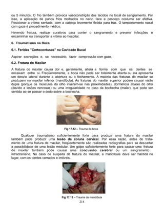 218
ou 5 minutos. O frio também provoca vasoconstrição dos tecidos no local de sangramento. Por
isso, a aplicação de panos frios molhados no nariz, face e pescoço costuma ser efetiva.
Posicionar a vítima sentada, com a cabeça levemente fletida para trás. O tamponamento nasal
com gaze é procedimento médico.
Havendo fratura, realizar curativos para conter o sangramento e prevenir infecções e
encaminhar ou transportar a vítima ao hospital.
6. Traumatismo na Boca
6.1. Feridas "Cortocontusas" na Cavidade Bucal
Aspirar secreções e, se necessário, fazer compressão com gaze.
6.2. Fratura do Maxilar
A fratura do maxilar causa dor e, geralmente, altera a forma com que os dentes se
encaixam entre si. Freqüentemente, a boca não pode ser totalmente aberta ou ela apresenta
um desvio lateral durante a abertura ou o fechamento. A maioria das fraturas do maxilar se
produzem no maxilar inferior (mandíbula). As fraturas do maxilar superior podem causar visão
dupla (porque os músculos do olho inserem-se nas proximidades), dormência abaixo do olho
(devido a lesões nervosas) ou uma irregularidade no osso da bochecha (malar), que pode ser
sentida ao se passar o dedo sobre a bochecha.
Fig 17.12 – Trauma de boca
Qualquer traumatismo suficientemente forte para produzir uma fratura do maxilar
também pode produzir uma lesão da coluna cervical. Por essa razão, antes do trata-
mento de uma fratura de maxilar, freqüentemente são realizadas radiografias para se descartar
a possibilidade de uma lesão medular. Um golpe suficientemente forte para causar uma fratura
do maxilar também pode causar uma concussão cerebral ou um sangramento
intracraniano. No caso de suspeita de fratura do maxilar, a mandíbula deve ser mantida no
lugar, com os dentes cerrados e imóveis.
Fig 17.13 – Trauma de mandíbula
 
