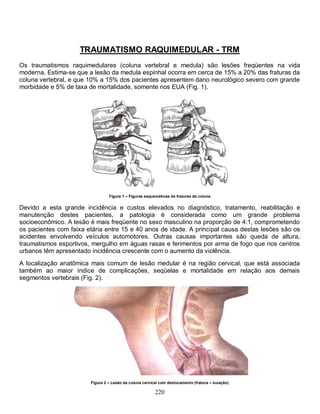 220
TRAUMATISMO RAQUIMEDULAR - TRM
Os traumatismos raquimedulares (coluna vertebral e medula) são lesões freqüentes na vida
moderna. Estima-se que a lesão da medula espinhal ocorra em cerca de 15% a 20% das fraturas da
coluna vertebral, e que 10% a 15% dos pacientes apresentem dano neurológico severo com grande
morbidade e 5% de taxa de mortalidade, somente nos EUA (Fig. 1).
Figura 1 – Figuras esquemáticas de fraturas da coluna
Devido a esta grande incidência e custos elevados no diagnóstico, tratamento, reabilitação e
manutenção destes pacientes, a patologia é considerada como um grande problema
socioeconômico. A lesão é mais freqüente no sexo masculino na proporção de 4:1, comprometendo
os pacientes com faixa etária entre 15 e 40 anos de idade. A principal causa destas lesões são os
acidentes envolvendo veículos automotores. Outras causas importantes são queda de altura,
traumatismos esportivos, mergulho em águas rasas e ferimentos por arma de fogo que nos centros
urbanos têm apresentado incidência crescente com o aumento da violência.
A localização anatômica mais comum de lesão medular é na região cervical, que está associada
também ao maior índice de complicações, seqüelas e mortalidade em relação aos demais
segmentos vertebrais (Fig. 2).
Figura 2 – Lesão da coluna cervical com deslocamento (fratura – luxação)
 