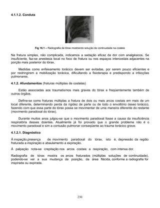 230
4.1.1.2. Conduta
Fig 16.1 – Radiografia de tórax mostrando solução de continuidade na costela
Na fratura simples, não complicada, indicamos a sedação eficaz da dor com analgésicos. Se
insuficiente, faz-se anestesia local no foco de fratura ou nos espaços intercostais adjacentes na
porção mais posterior do tórax.
Medidas como enfaixamento torácico devem ser evitadas, por serem pouco eficientes e
por restringirem a mobilização torácica, dificultando a fisioterapia e predispondo a infecções
pulmonares.
4.1.2. Afundamentos (fraturas múltiplas de costelas)
Estão associadas aos traumatismos mais graves do tórax e freqüentemente também de
outros órgãos.
Define-se como fraturas múltiplas a fratura de dois ou mais arcos costais em mais de um
local diferente, determinando perda da rigidez de parte ou de todo o envoltório ósseo torácico,
fazendo com que essa parte do tórax possa se movimentar de uma maneira diferente do restante
(movimento paradoxal do tórax).
Durante muitos anos julgou-se que o movimento paradoxal fosse a causa da insuficiência
respiratória desses doentes. Atualmente já foi provado que o grande problema não é o
movimento paradoxal e sim a contusão pulmonar conseqüente ao trauma torácico grave.
4.1.2.1. Diagnóstico
À inspeção,presença de movimento paradoxal do tórax, isto é, depressão da região
fraturada a inspiração e abaulamento a expiração.
À palpação nota-se crepitação nos arcos costais a respiração, com intensa dor.
Radiografia de tórax mostra os arcos fraturados (múltiplas soluções de continuidade),
podendo-se ver a sua mudança de posição, da área flácida, conforme a radiografia for
inspirada ou expirada.
 