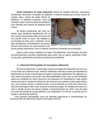 245
Sinais indicativos de lesão abdominal: fratura de costelas inferiores, equimoses,
hematomas, ferimentos na parede do abdômen. A mesma energia que provoca fratura de
costela, pelve, coluna faz lesão interna do
abdômen. O abdômen escavado, como se
estivesse vazio, é sinal de lesão do diafragma,
com migração das vísceras do abdômen para
o tórax.
As lesões penetrantes são mais evi-
dentes; logo, facilmente identificáveis. Em al-
guns casos, essas lesões estão em locais me-
nos visíveis, como no dorso, nas nádegas ou
na transição do tórax com o abdômen. As le-
sões penetrantes, principalmente as produzi-
das por arma branca, às vezes causam a saí-
Fig 16.6 – Trauma fechado causado por cinto
da de vísceras abdominais, como o intestino, fenômeno conhecido por evisceração.
Alguns outros sinais indicativos de lesão intra-abdominal: arroxeamento da bolsa
escrotal (equimose escrotal), sangramento pela uretra, reto ou vagina, associada a fratu-
ras da pelve, geralmente com lesão em estruturas do abdômen.
4. Tratamento Pré-hospitalar do Traumatismo Abdominal
No trauma abdominal, a hemorragia constitui prioridade de tratamento, por ser cau-
sa de morte nas primeiras horas. Nenhum tratamento instituído na fase pré-hospitalar do
atendimento vai conter a hemorragia de órgãos e estruturas abdominais. Em algumas víti-
mas, essa hemorragia é mais lenta e dá certa estabilidade inicial, mas, se não controlada,
agrava as condições da vítima. Devemos nos preocupar em transportá-la o mais rapida-
mente possível ao hospital de referência, sem demora com medidas muitas vezes inefica-
zes, como acesso venoso e infusão de soro. O soro infundido na vítima sem prévio con-
trole da hemorragia muitas vezes aumenta a perda de sangue. As medidas de acesso ve-
noso e infusão de soro não devem retardar o encaminhamento da vítima, mas são úteis
em casos de transporte a longa distância, que ultrapassem 10 minutos, e quando não re-
tardem o atendimento definitivo.
Todo paciente traumatizado deve ser atendido seguindo-se a sistematização do
exame primário do Advanced Trauma Life Support (ATLS).
 