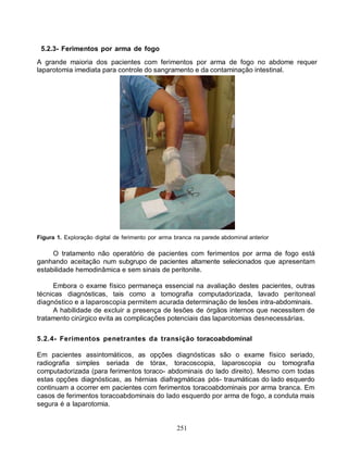 251
5.2.3- Ferimentos por arma de fogo
A grande maioria dos pacientes com ferimentos por arma de fogo no abdome requer
laparotomia imediata para controle do sangramento e da contaminação intestinal.
Figura 1. Exploração digital de ferimento por arma branca na parede abdominal anterior
O tratamento não operatório de pacientes com ferimentos por arma de fogo está
ganhando aceitação num subgrupo de pacientes altamente selecionados que apresentam
estabilidade hemodinâmica e sem sinais de peritonite.
Embora o exame físico permaneça essencial na avaliação destes pacientes, outras
técnicas diagnósticas, tais como a tomografia computadorizada, lavado peritoneal
diagnóstico e a laparoscopia permitem acurada determinação de lesões intra-abdominais.
A habilidade de excluir a presença de lesões de órgãos internos que necessitem de
tratamento cirúrgico evita as complicações potenciais das laparotomias desnecessárias.
5.2.4- Ferimentos penetrantes da transição toracoabdominal
Em pacientes assintomáticos, as opções diagnósticas são o exame físico seriado,
radiografia simples seriada de tórax, toracoscopia, laparoscopia ou tomografia
computadorizada (para ferimentos toraco- abdominais do lado direito). Mesmo com todas
estas opções diagnósticas, as hérnias diafragmáticas pós- traumáticas do lado esquerdo
continuam a ocorrer em pacientes com ferimentos toracoabdominais por arma branca. Em
casos de ferimentos toracoabdominais do lado esquerdo por arma de fogo, a conduta mais
segura é a laparotomia.
 