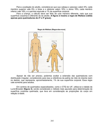 283
Para a avaliação do adulto, considera-se que sua cabeça e pescoço valem 9%; cada
membro superior vale 9%; o tórax e o abdome valem 18%; o dorso 18%; cada membro
inferior vale 18%; e o períneo equivale a 1% da superfície corporal.
Para a criança, o cálculo deve ser feito de uma maneira diferente, visto que sua
superfície corpórea é diferente da do adulto. A figura 2 mostra a regra de Wallace (válida
apenas para queimaduras de 2º e 3º graus).
Regra de Wallace (Regra-dos-nove)
Apesar de não ser preciso, podemos avaliar a extensão das queimaduras com
distribuição irregular, considerando para isso a referência da palma da mão do doente (sem
os dedos), que representa, aproximadamente, 1% de sua superfície corporal. Essa regra
vale somente para adultos.
Em centros de queimados especializados, como o CTQ do IJF, utiliza-se a tabela de
Lund-Browder (figura 3), sendo considerado o método mais apurado para determinação da
superfície corpórea queimada, que leva em consideração as proporções do corpo em
relação à idade.
 