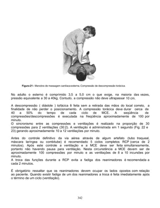 342
Figura 21 - Manobra de massagem cardíaca externa. Compressão de descompressão torácica.
No adulto o esterno é comprimido 3,5 a 5,0 cm o que exige, na maioria das vezes,
pressão equivalente a 30 a 40kg. Contudo, a compressão não deve ultrapassar 10 cm.
A descompressão ( diástole ) torácica é feita sem a retirada das mãos do local correto, a
finalidade de não perder o posicionamento. A compressão torácica deve durar cerca de
40 a 50% do tempo de cada ciclo de MCE. A seqüência de
compressões/descompressões é executada na freqüência aproximadamente de 100 por
minuto.
O sincronismo entre as compressões e ventilações é realizado na proporção de 30
compressões para 2 ventilações (30:2). A ventilação é administrada em 1 segundo (Fig. 22 e
23) gerando aproximadamente 10 a 12 ventilações por minuto.
Antes do controle definitivo da via aérea através de algum artefato (tubo traqueal,
máscara laríngea ou combitube) é recomendado 5 ciclos completos RCP (cerca de 2
minutos). Após este controle a ventilação e a MCE deve ser feita simultaneamente,
portanto não havendo pausa para ventilação. Nesta circunstância a MCE devem ser de
aproximadamente 100 compressões por minuto e as ventilações de 8 a 10 incursões por
minuto.
A troca das funções durante a RCP evita a fadiga dos reanimadores é recomendada a
cada 2 minutos.
É obrigatório ressaltar que os reanimadores devem ocupar os lados opostos com relação
ao paciente. Quando existir fadiga de um dos reanimadores a troca é feita imediatamente após
o término de um ciclo (ventilação).
 