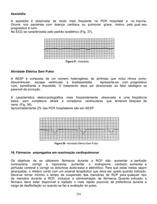 354
Assistolia
A assistolia é observada de modo mais freqüente na PCR hospitalar e no trauma.
Ocorre nos pacientes com doença cardíaca ou pulmonar grave, motivo pelo qual seu
prognóstico é ruim.
No ECG se caracterizada pelo padrão isoelétrico (Fig. 37).
Figura 37 - Assistolia.
Atividade Elétrica Sem Pulso
A AESP é composta de um número heterogêneo de arritmias que inclui ritmos como:
idioventricular, escape ventricular e bradiassistolia. Apresenta-se com prognóstico
ruim, semelhante a Assistolia. O tratamento deve ser direcionado ao fator etiológico se
passível de correção.
A característica eletrocardiográfica mais freqüentemente observada é uma freqüência
baixa, sem complexos atriais e complexos ventriculares que lembram bloqueio de
ramo (Fig. 38).
Aproximadamente 2% das PCR hospitalares são em AESP.
Figura 38 - Atividade Elétrica Sem Pulso.
16. Fármacos empregados em reanimação cardiopulmonar
Os objetivos de se utilizarem fármacos durante a RCP são: aumentar a perfusão
coronariana, corrigir a hipoxemia, aumentar o inotropismo cardíaco, aumentar a
perfusão cerebral e corrigir os distúrbios ácido-base e eletrolítico. Para que estas metas sejam
alcançadas, o médico conta com um arsenal terapêutico que deve ser usado quando indicado.
Deve-se tornar mínimo o tempo de suspensão das manobras de RCP para qualquer tipo
de manobra durante a RCP, inclusive a administração de fármacos. Quando indicado, o
fármaco deve estar disponível e injetado o mais rápido possível, de preferência durante a
carga de desfibrilação ou quando se faz a avaliação do pulso.
 