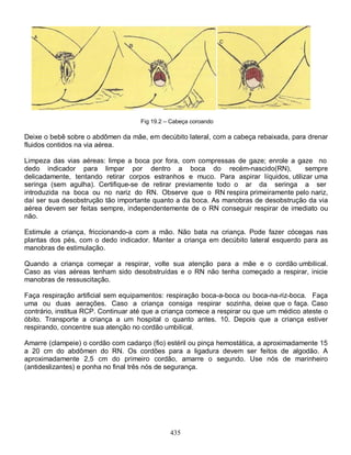 435
Fig 19.2 – Cabeça coroando
Deixe o bebê sobre o abdômen da mãe, em decúbito lateral, com a cabeça rebaixada, para drenar
fluidos contidos na via aérea.
Limpeza das vias aéreas: limpe a boca por fora, com compressas de gaze; enrole a gaze no
dedo indicador para limpar por dentro a boca do recém-nascido(RN), sempre
delicadamente, tentando retirar corpos estranhos e muco. Para aspirar líquidos, utilizar uma
seringa (sem agulha). Certifique-se de retirar previamente todo o ar da seringa a ser
introduzida na boca ou no nariz do RN. Observe que o RN respira primeiramente pelo nariz,
daí ser sua desobstrução tão importante quanto a da boca. As manobras de desobstrução da via
aérea devem ser feitas sempre, independentemente de o RN conseguir respirar de imediato ou
não.
Estimule a criança, friccionando-a com a mão. Não bata na criança. Pode fazer cócegas nas
plantas dos pés, com o dedo indicador. Manter a criança em decúbito lateral esquerdo para as
manobras de estimulação.
Quando a criança começar a respirar, volte sua atenção para a mãe e o cordão umbilical.
Caso as vias aéreas tenham sido desobstruídas e o RN não tenha começado a respirar, inicie
manobras de ressuscitação.
Faça respiração artificial sem equipamentos: respiração boca-a-boca ou boca-na-riz-boca. Faça
uma ou duas aerações. Caso a criança consiga respirar sozinha, deixe que o faça. Caso
contrário, institua RCP. Continuar até que a criança comece a respirar ou que um médico ateste o
óbito. Transporte a criança a um hospital o quanto antes. 10. Depois que a criança estiver
respirando, concentre sua atenção no cordão umbilical.
Amarre (clampeie) o cordão com cadarço (fio) estéril ou pinça hemostática, a aproximadamente 15
a 20 cm do abdômen do RN. Os cordões para a ligadura devem ser feitos de algodão. A
aproximadamente 2,5 cm do primeiro cordão, amarre o segundo. Use nós de marinheiro
(antideslizantes) e ponha no final três nós de segurança.
 