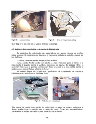 - 65 -
Fig 4.15 – Ação do Airbag Fig 4.16 – Cinto de três pontos e Airbag
O air bag deve associar-se ao uso do cinto de segurança.
4.7. Acidente Automobilístico – Acidente de Motocicleta
Os acidentes de motocicleta são responsáveis por grande número de mortes
todos os anos. O mecanismo de trauma é o mesmo da colisão de veículo e segue as
leis da Física.
O uso do capacete previne lesões de face e crânio.
Numa colisão frontal contra um objeto, a moto inclina-se para a frente e o
motociclista é jogado contra o guidom, esperando-se trauma de cabeça, tórax e
abdômen. Caso pés e pernas permaneçam fixos no pedal e a coxa colida contra o
guidom, pode ocorrer fratura bilateral de fêmur.
Na colisão lateral do motociclista, geralmente há compressão de membros
inferiores provocando fraturas de tíbia e fíbula.
Fig 4.17 – Acidentes com motocicletas.
Nos casos de colisão com ejeção do motociclista, o ponto de impacto determina a
lesão, irradiando-se a energia para o resto do corpo. Como nos automobilísticos,
geralmente as lesões são muito graves nesse tipo de acidente.
 
