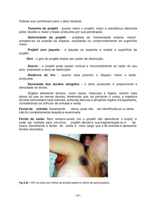 - 69 -
Fatores que contribuem para o dano tecidual.
Tamanho do projétil - quanto maior o projétil, maior a resistência oferecida
pelos tecidos e maior a lesão produzida por sua penetração.
Deformidade do projétil - projéteis de "extremidade anterior macia"
achatam-se na ocasião do impacto, resultando no comprometimento de superfície
maior.
Projétil com jaqueta - a jaqueta se expande e amplia a superfície do
projétil.
Giro - o giro do projétil amplia seu poder de destruição.
Desvio - o projétil pode oscilar vertical e horizontalmente ao redor do seu
eixo, ampliando a área de destruição.
Distância do tiro - quanto mais próximo o disparo, maior a lesão
produzida.
Densidade dos tecidos atingidos - o dano produzido é proporcional a
densidade do tecido.
Órgãos altamente densos, como ossos, músculos e fígado, sofrem mais
danos do que os menos densos, lembrando que, ao percorrer o corpo, a trajetória
da bala nem sempre será retilínea, sofrendo desvios e atingindo órgãos insuspeitados,
considerando os orifícios de entrada e saída.
Ferida de entrada: Geralmente óbvia, pode não ser identificada se a vítima
não for completamente despida e examinada.
Ferida de saída: Nem sempre existe (se o projétil não abandonar o corpo) e
pode ser múltipla para um único projétil, devido a sua fragmentação ou a de
ossos. Geralmente a ferida de saída é mais larga que a de entrada e apresenta
bordos lacerados.
Fig 4.22 – FAF em tórax com orifício de entrada anterior e orifício de saída posterior.
 
