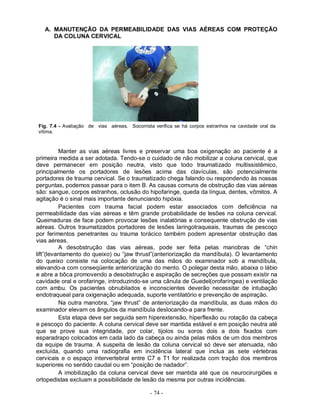- 74 -
A. MANUTENÇÃO DA PERMEABILIDADE DAS VIAS AÉREAS COM PROTEÇÃO
DA COLUNA CERVICAL
Fig. 7.4 - Avaliação de vias aéreas. Socorrista verifica se há corpos estranhos na cavidade oral da
vítima.
Manter as vias aéreas livres e preservar uma boa oxigenação ao paciente é a
primeira medida a ser adotada. Tendo-se o cuidado de não mobilizar a coluna cervical, que
deve permanecer em posição neutra, visto que todo traumatizado multissistêmico,
principalmente os portadores de lesões acima das clavículas, são potencialmente
portadores de trauma cervical. Se o traumatizado chega falando ou respondendo às nossas
perguntas, podemos passar para o item B. As causas comuns de obstrução das vias aéreas
são: sangue, corpos estranhos, oclusão do hipofaringe, queda da língua, dentes, vômitos. A
agitação é o sinal mais importante denunciando hipóxia.
Pacientes com trauma facial podem estar associados com deficiência na
permeabilidade das vias aéreas e têm grande probabilidade de lesões na coluna cervical.
Queimaduras de face podem provocar lesões inalatórias e consequente obstrução de vias
aéreas. Outros traumatizados portadores de lesões laringotraqueais, traumas de pescoço
por ferimentos penetrantes ou trauma torácico também podem apresentar obstrução das
vias aéreas.
A desobstrução das vias aéreas, pode ser feita pelas manobras de “chin
lift”(levantamento do queixo) ou “jaw thrust”(anteriorização da mandíbula). O levantamento
do queixo consiste na colocação de uma das mãos do examinador sob a mandíbula,
elevando-a com conseqüente anteriorização do mento. O polegar desta mão, abaixa o lábio
e abre a bôca promovendo a desobstrução e aspiração de secreções que possam existir na
cavidade oral e orofaringe, introduzindo-se uma cânula de Guedel(orofaríngea) e ventilação
com ambu. Os pacientes obnubilados e inconscientes deverão necessitar de intubação
endotraqueal para oxigenação adequada, suporte ventilatório e prevenção de aspiração.
Na outra manobra, “jaw thrust” de anteriorização da mandíbula, as duas mãos do
examinador elevam os ângulos da mandíbula deslocando-a para frente.
Esta etapa deve ser seguida sem hiperextensão, hiperflexão ou rotação da cabeça
e pescoço do paciente. A coluna cervical deve ser mantida estável e em posição neutra até
que se prove sua integridade, por colar, tijolos ou soros dois a dois fixados com
esparadrapo colocados em cada lado da cabeça ou ainda pelas mãos de um dos membros
da equipe de trauma. A suspeita de lesão da coluna cervical só deve ser atenuada, não
excluída, quando uma radiografia em incidência lateral que inclua as sete vértebras
cervicais e o espaço intervertebral entre C7 e T1 for realizada com tração dos membros
superiores no sentido caudal ou em “posição de nadador”.
A imobilização da coluna cervical deve ser mantida até que os neurocirurgiões e
ortopedistas excluam a possibilidade de lesão da mesma por outras incidências.
 