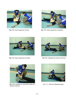 - 81 -
Fig. 7.12 - Exame segmentar do tórax. Fig. 7.13 - Exame segmentar do abdômen.
Fig. 7.14 - Exame segmentar do quadril. Fig. 7.15 - Palpação dos membros inferiores.
Fig. 7.16 - Avaliação do enchimento capilar dos Fig. 7.17 - Teste de mobilidade passiva.
membros inferiores.
 