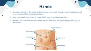 Appendicitis and Hernia.pptx
