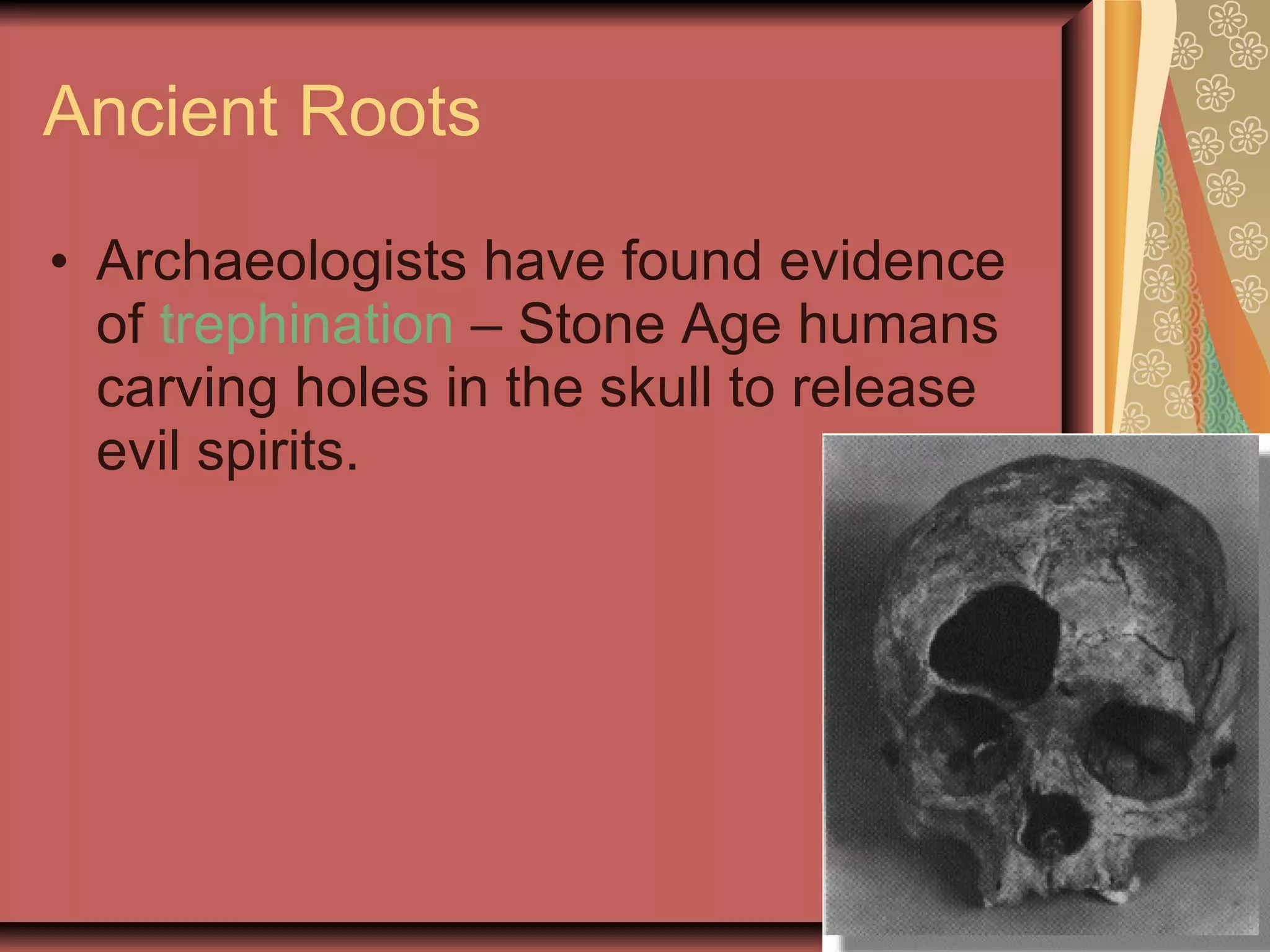 Ancient Roots Archaeologists have found evidence of  trephination  – Stone Age humans carving holes in the skull to release evil spirits. 