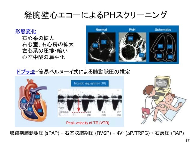 4v2 Rvsp Aphj slides20150710