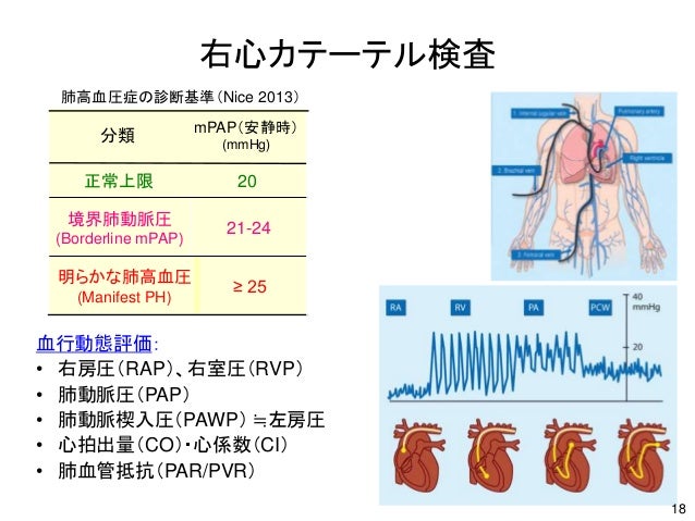 Aphj slides20150710Aphj slides20150710