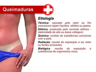 Térmica: causada pelo calor ou frio
excessivos sejam líquidos, sólidos ou gazes;
Elétrica: produzida pela corrente elétrica -
eletricidade de alta ou baixa voltagem;
Química: contato de substâncias corrosivas
com a pele;
Radiação: resulta da exposição a luz solar
ou fontes ionizantes.
Biológica: resulta da exposição a
substâncias de organismos vivos.
EtiologiaEtiologia
 