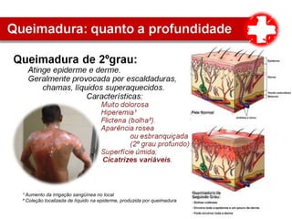 ¹ Aumento da irrigação sangüínea no local
² Coleção localizada de líquido na epiderme, produzida por queimadura
 