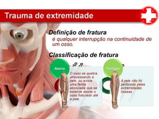 Definição de fratura
é qualquer interrupção na continuidade de
um osso.
Classificação de fratura
 