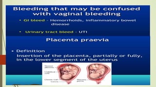 APH PPT.pdf