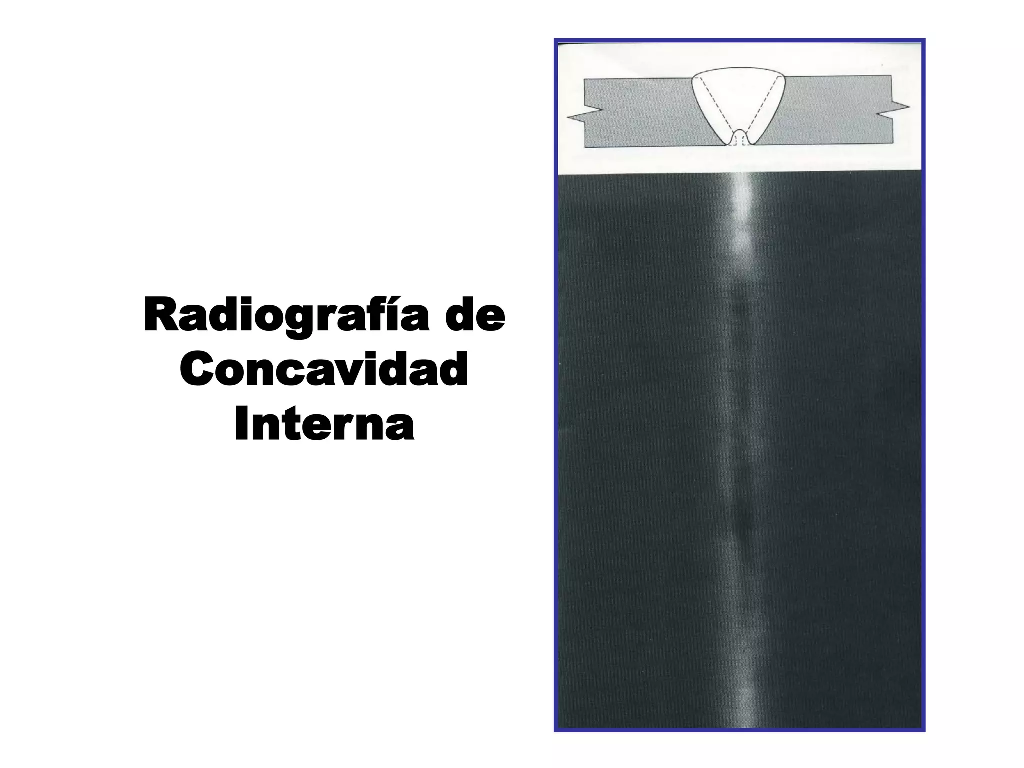 Radiografía de
Concavidad
Interna
 