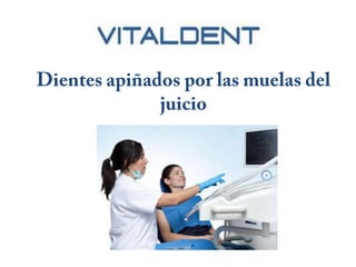 Vital Dent Valencia y el apiñamiento dental