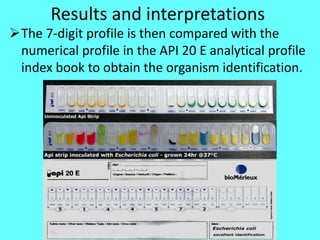 Analytical Profile Index (API) & Automated Machines | PPTX