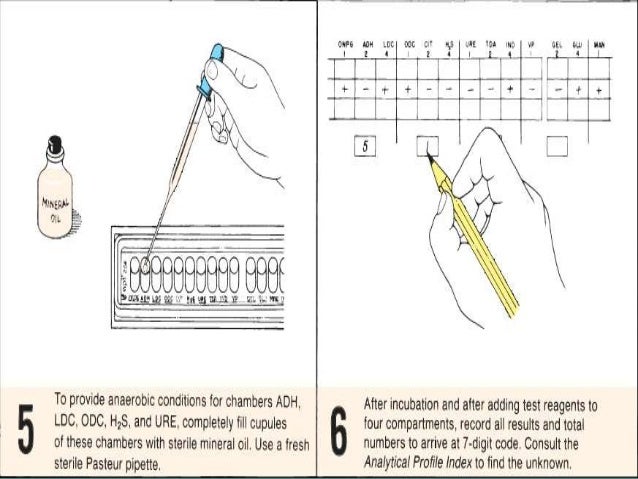 Analytical Profile Index (API) & Automated Machines