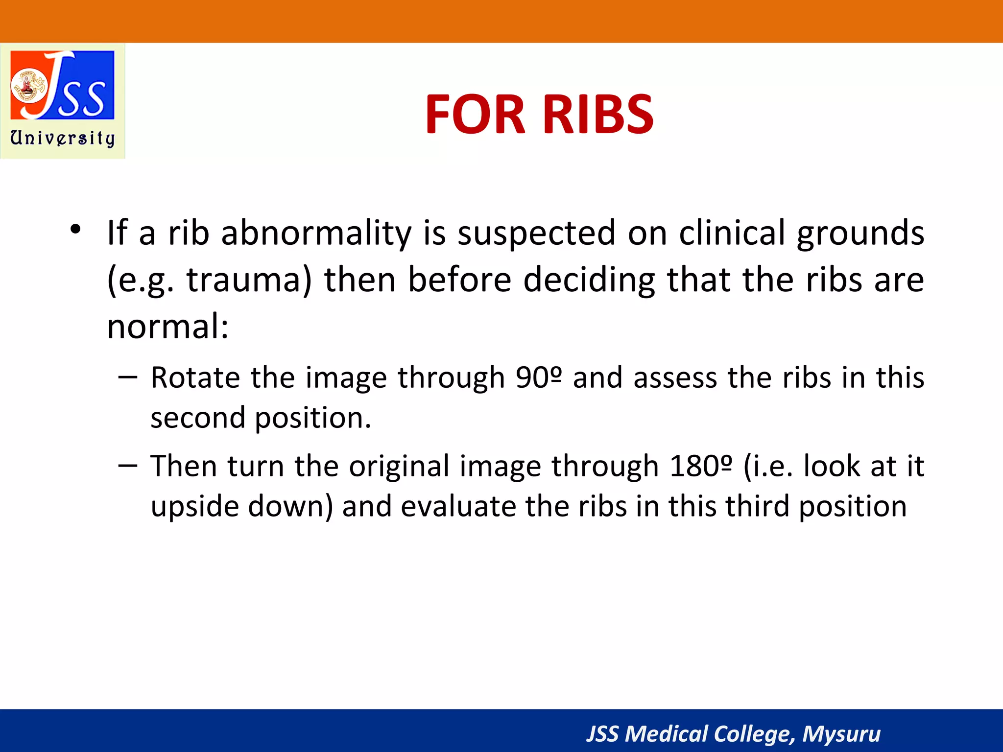 Rib 3rd Rib Position Approach to Chest X-Ray and Interpretation | PPT