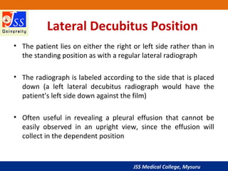 JSS Medical College, Mysuru
Lateral Decubitus Position
• The patient lies on either the right or left side rather than in
the standing position as with a regular lateral radiograph
• The radiograph is labeled according to the side that is placed
down (a left lateral decubitus radiograph would have the
patient’s left side down against the film)
• Often useful in revealing a pleural effusion that cannot be
easily observed in an upright view, since the effusion will
collect in the dependent position
 