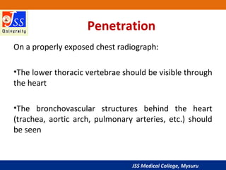 JSS Medical College, Mysuru
Penetration
On a properly exposed chest radiograph:
•The lower thoracic vertebrae should be visible through
the heart
•The bronchovascular structures behind the heart
(trachea, aortic arch, pulmonary arteries, etc.) should
be seen
 